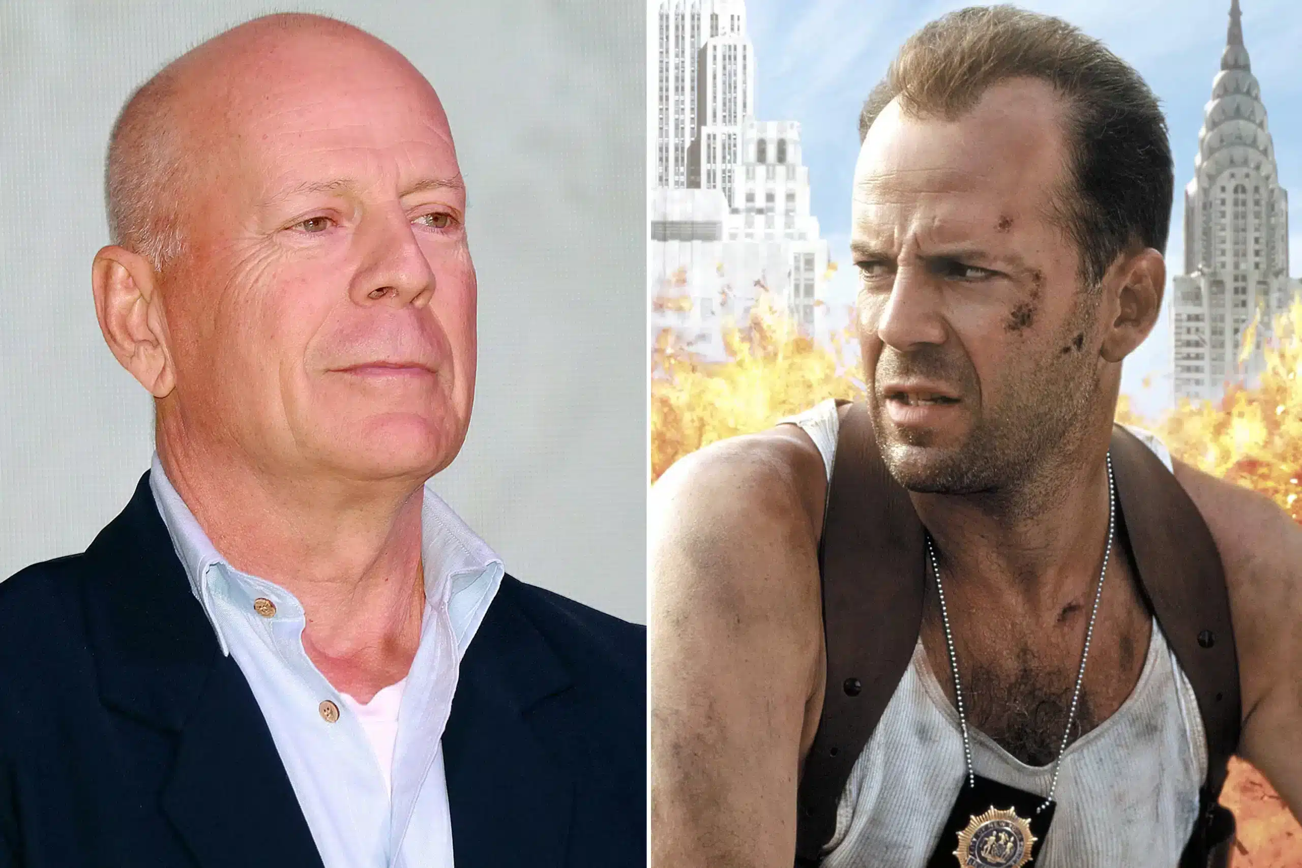 Bruce Willis Dementia Diagnosis and Hospice Care